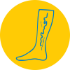 Mpct web site elemets varicose veins